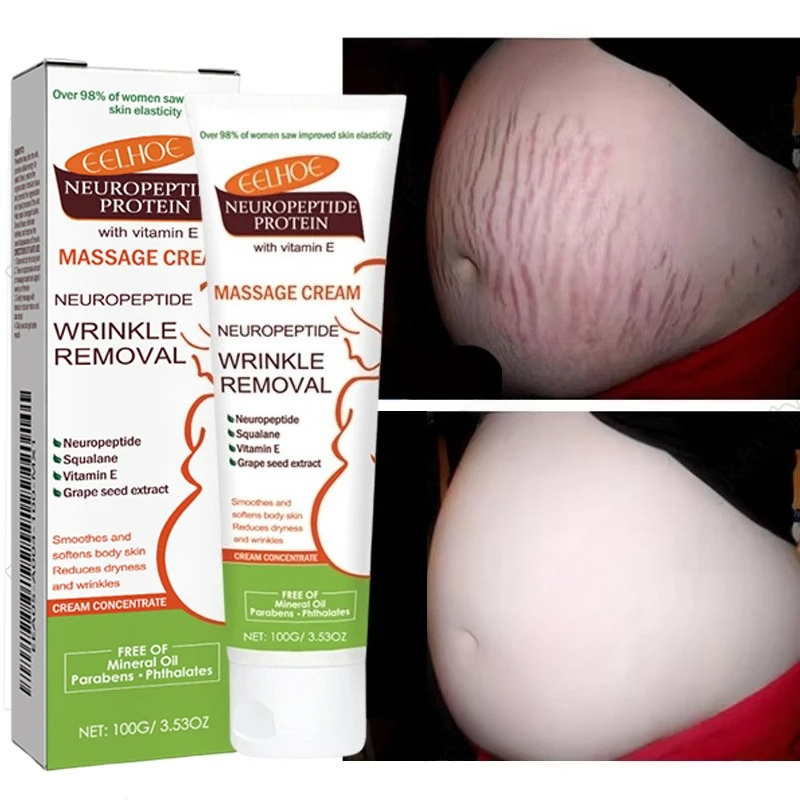 Teeth Whitening Pregnancy - Creme para Remoção Permanente de Estrias