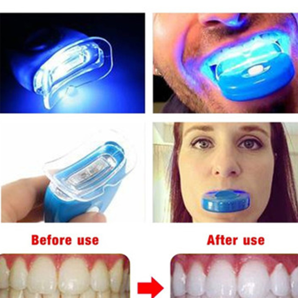 Led dentes branqueamento luz a - Teeth Whitening Laser Treatment avaliação e preço