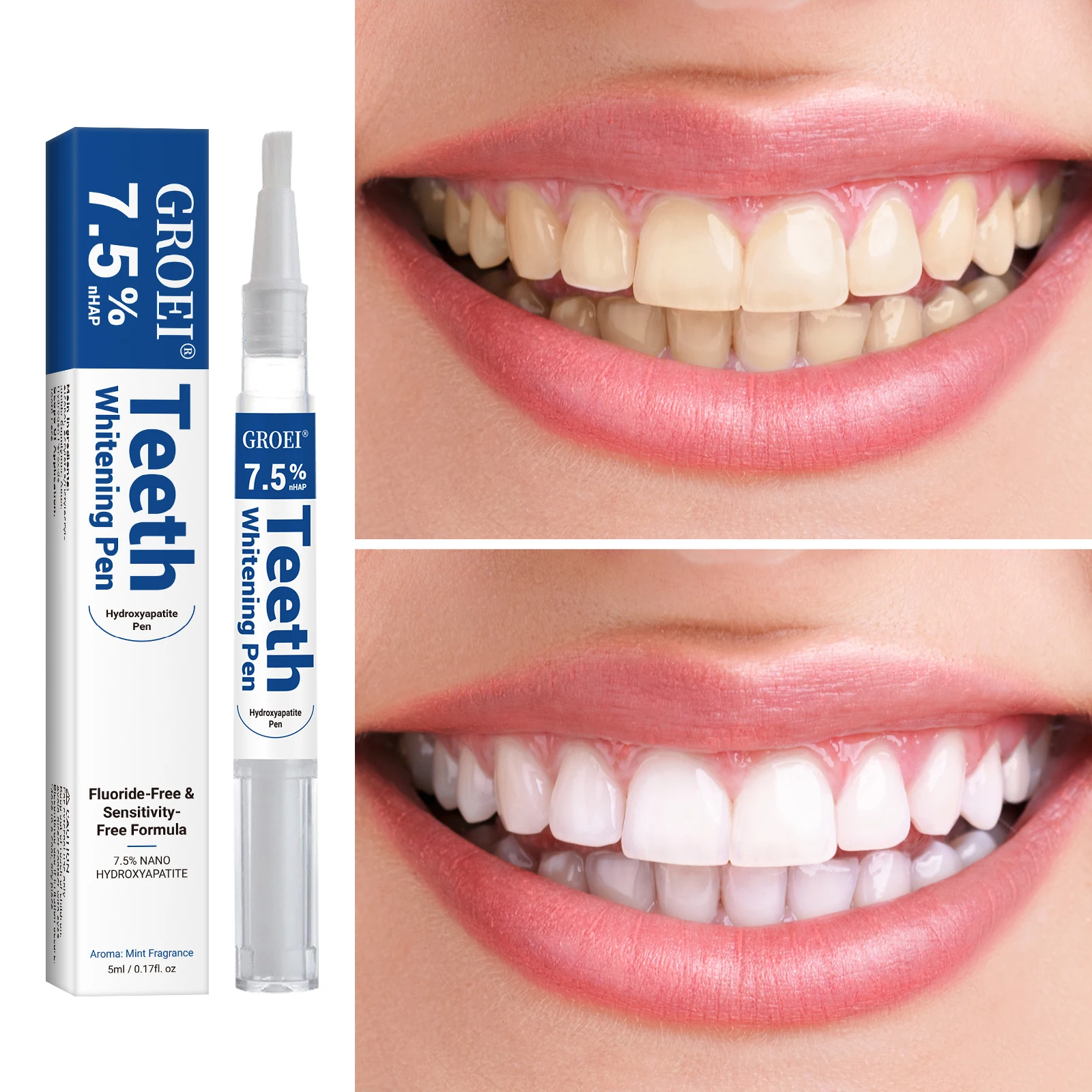 Caneta branqueadora de dente h - Teeth Whitening App avaliação e preço