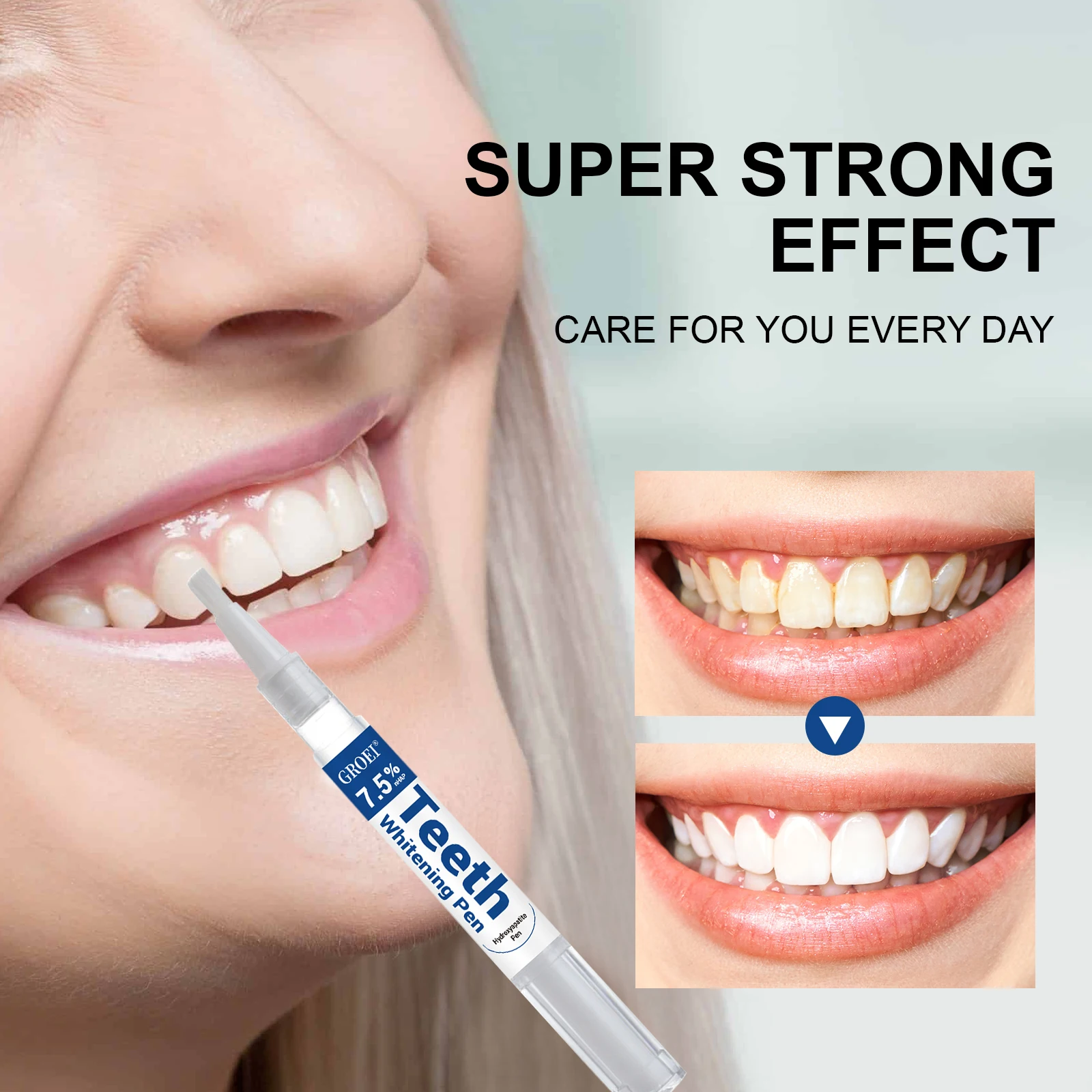 Caneta branqueadora de dente h - Teeth Whitening App avaliação e preço