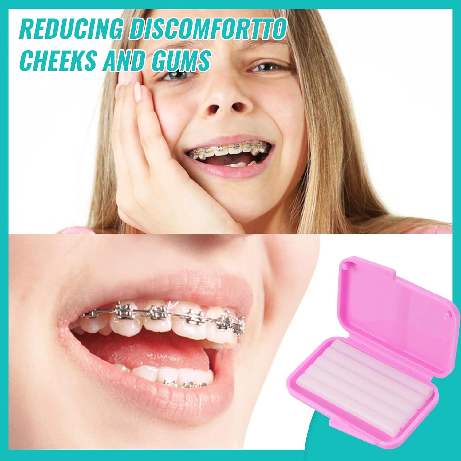 10 caixas de cera ortodôntica  - Teeth Whitening For Braces avaliação e preço