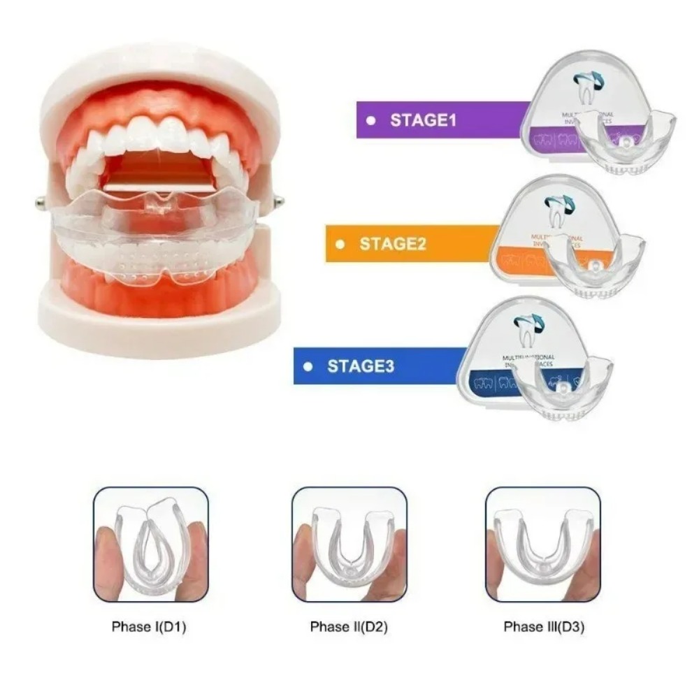 Aparelho Ortodôntico Alinhador - Teeth Whitening For Braces avaliação e preço
