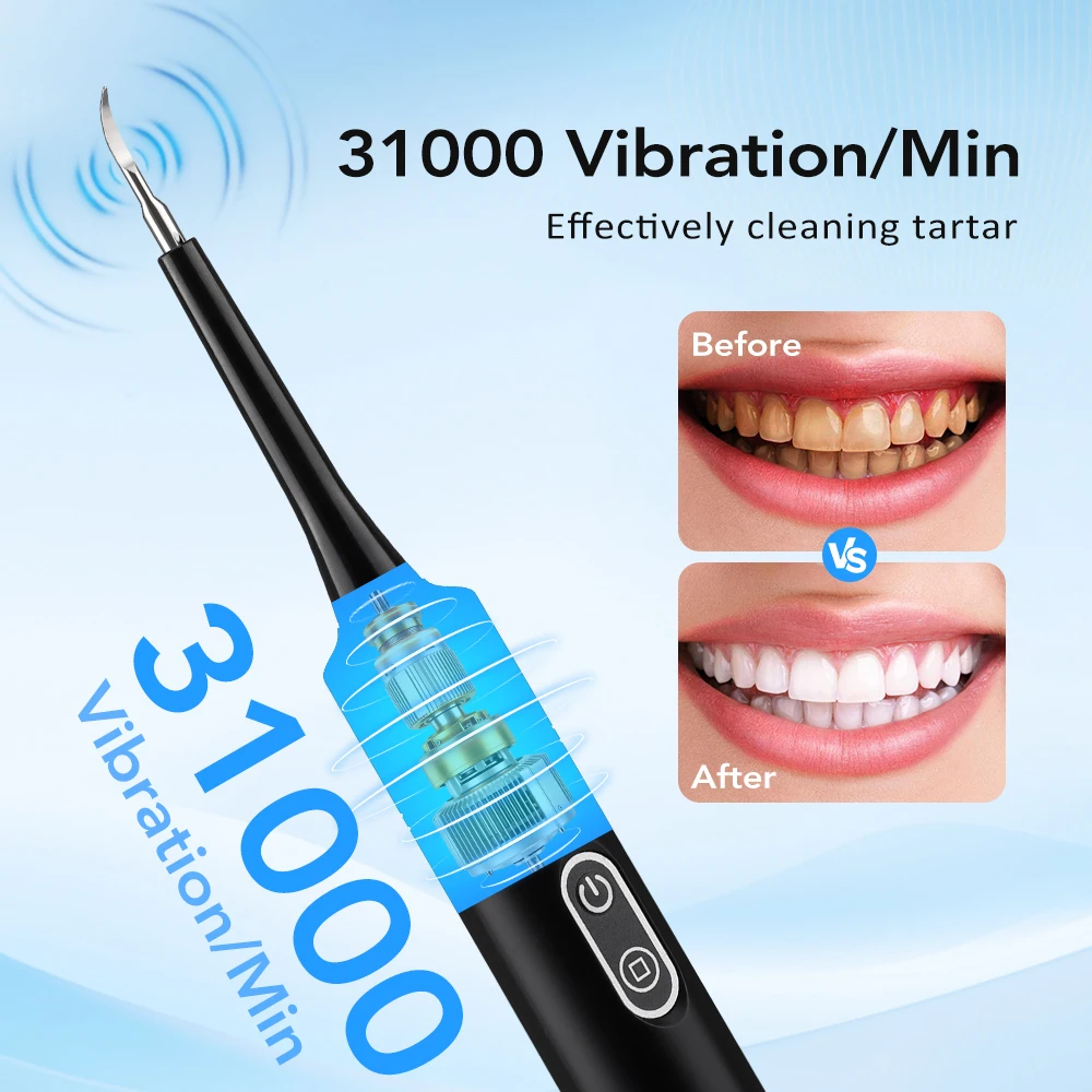Escova de Dentes Elétrica com  - Teeth Whitening Kit Professional avaliação e preço